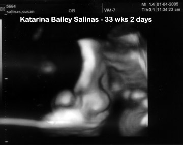 Katarina Bailey Salinas, direct from Suzie's womb!